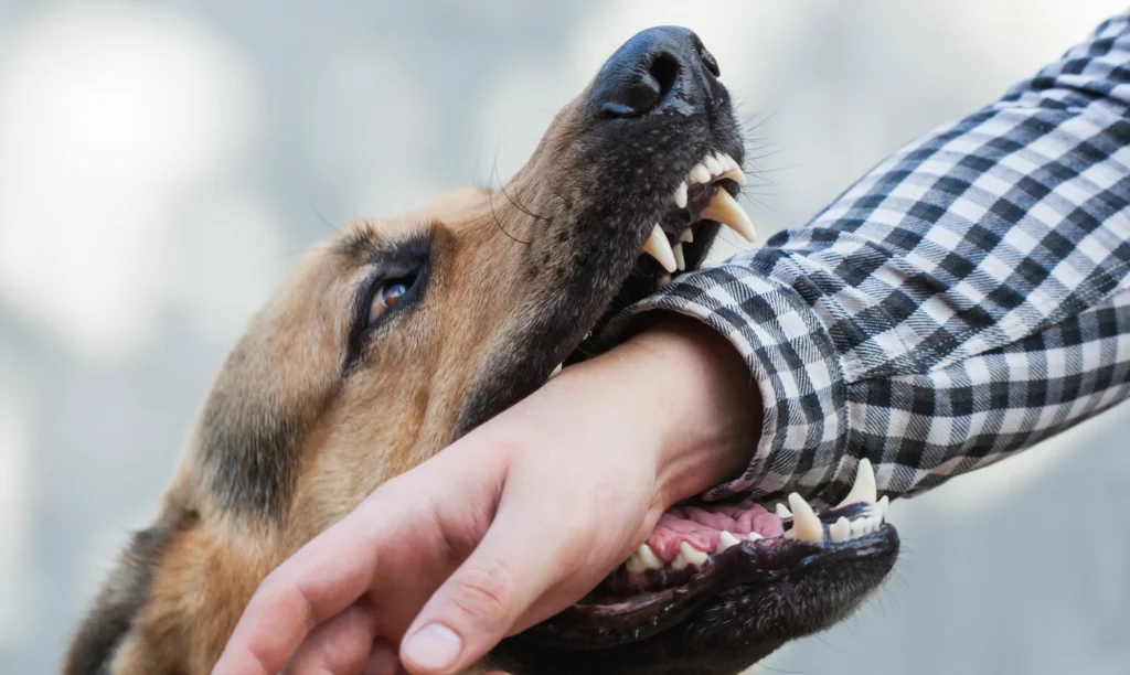 Close-up of a dog biting a person’s arm through a checkered shirt, showing the dog’s teeth and the person’s hand.
