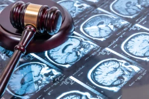 Understanding Brain Injuries and Their Impact